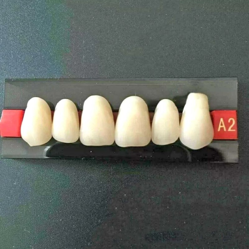 Unbranded 96PCS/Card Dental Tooth Veneer Anterior Resin Thin Teeth Veneers