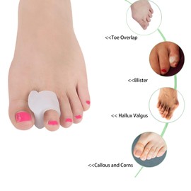 Misorita 12pcs Gel Toe Spacers include sizes S M L, Toe Separators to Correct Your Toes, Toe Support Big Toe Spacers for Overlapping Toes Bunions Hammer Toe Relaxation Restore Toes to Their Original Shape