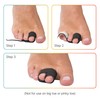ZenToes Hammer Toe Corrector for Women & Men - Reusable