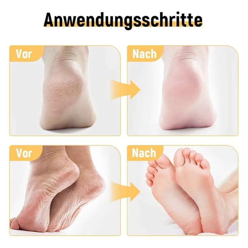 Crema Hidratante Para Pies, Repara E Hidrata Los Pies Secos