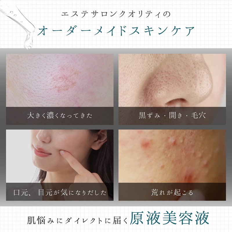 Licorice Extract Solution Natural Plant Extract, Item Solution, G・L, Sunburn,