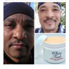 Crema aclaradora White Fade Super Skin, Para Piel Triguena O