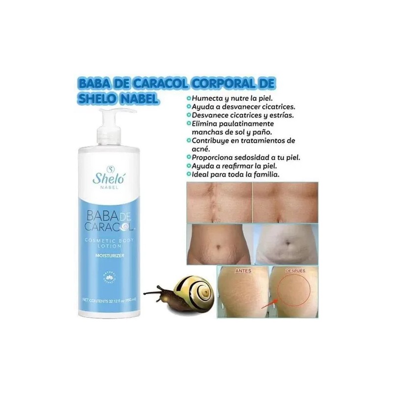2 Baba Caracol Corporal Manchas & Cicatrices Sheló Nabel
