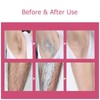 Haarentfernungscreme Körper Enthaarungscreme Sanfte Haarentfernungscreme Painless Hair Remover Cream Verbrennt