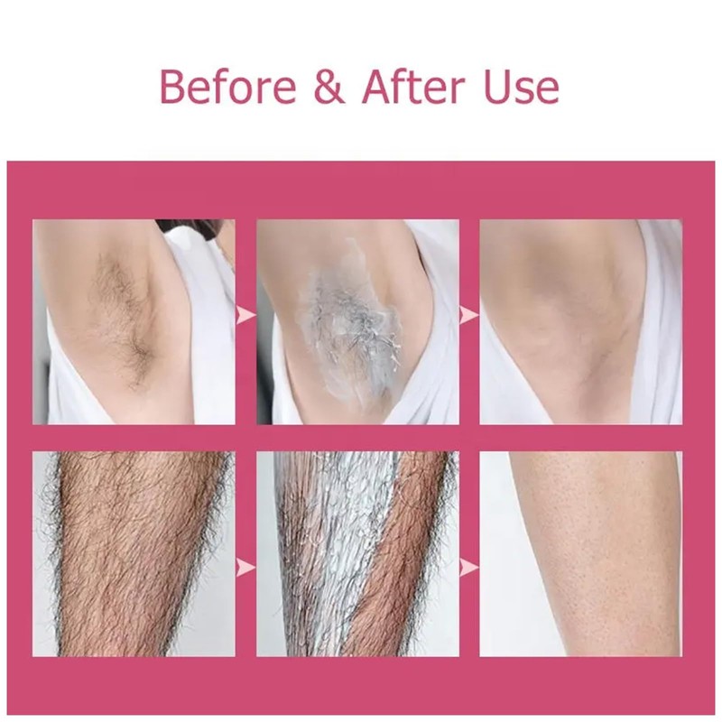 Haarentfernungscreme Körper Enthaarungscreme Sanfte Haarentfernungscreme Painless Hair Remover Cream Verbrennt