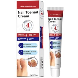 Nail Toenail Cream, Organic Herbal Formula for Thick Discoloured Nails, 20g