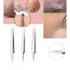 3PCS Ultra-fine Cell Pimples Clip Acne Tool Blackhead Zits Removal