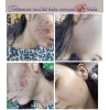 Crema Facial +jabón Facial Y Corporal Baba De Caracol Shelo