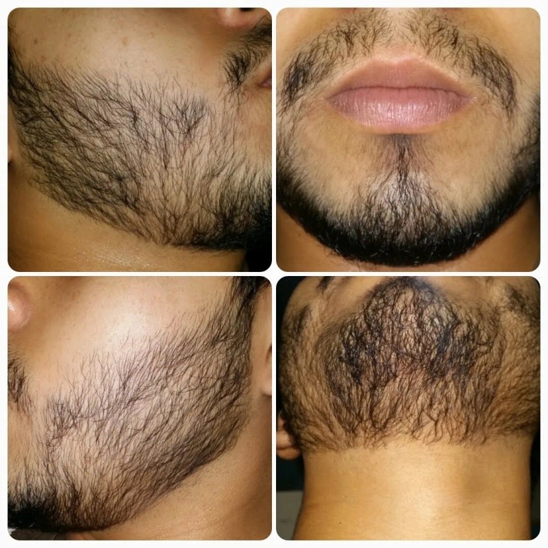 Jabón Bergamota,aceite Para La Barba,shampoo Bergamota