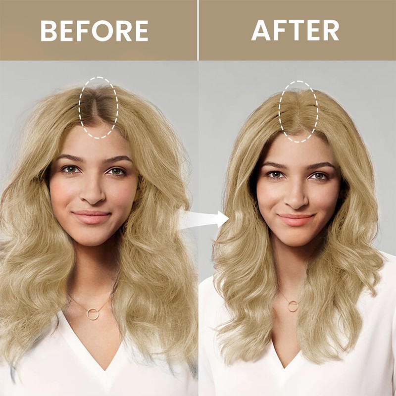 VOLLUCK Root Touch up Powder, Instant Hairline Powder for Thinning