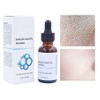Salicylic Acid Concentrate Super Strong 2% - Acne Spot Treatment
