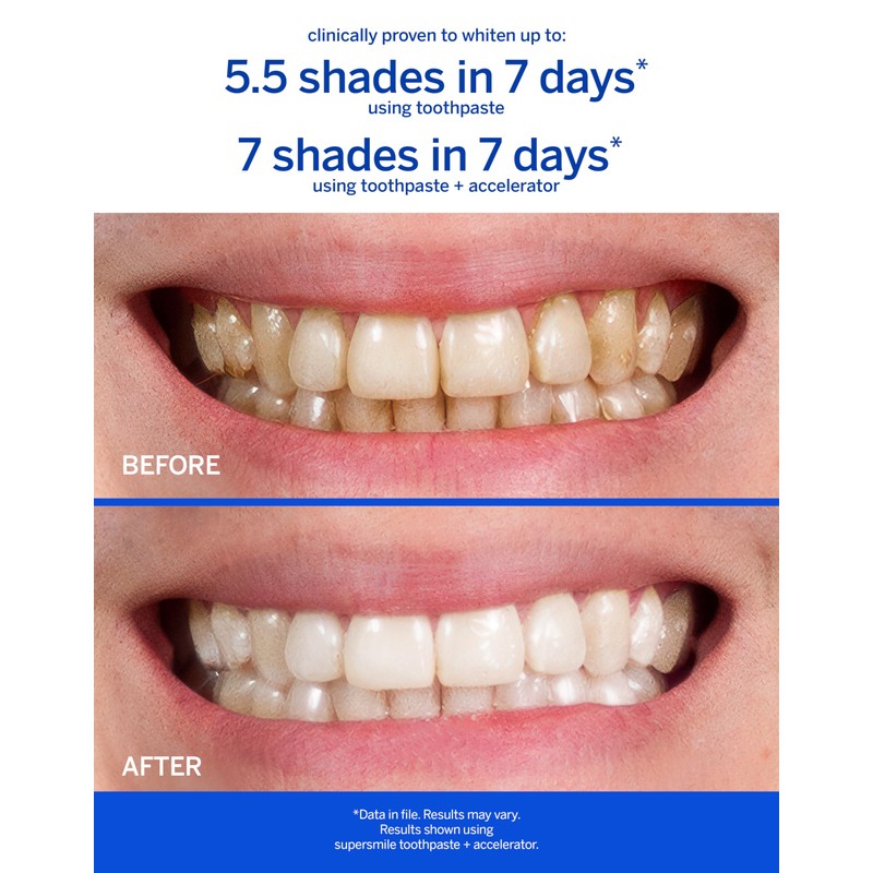 Supersmile Teeth Whitening System - Whitening Toothpaste and Accelerator -