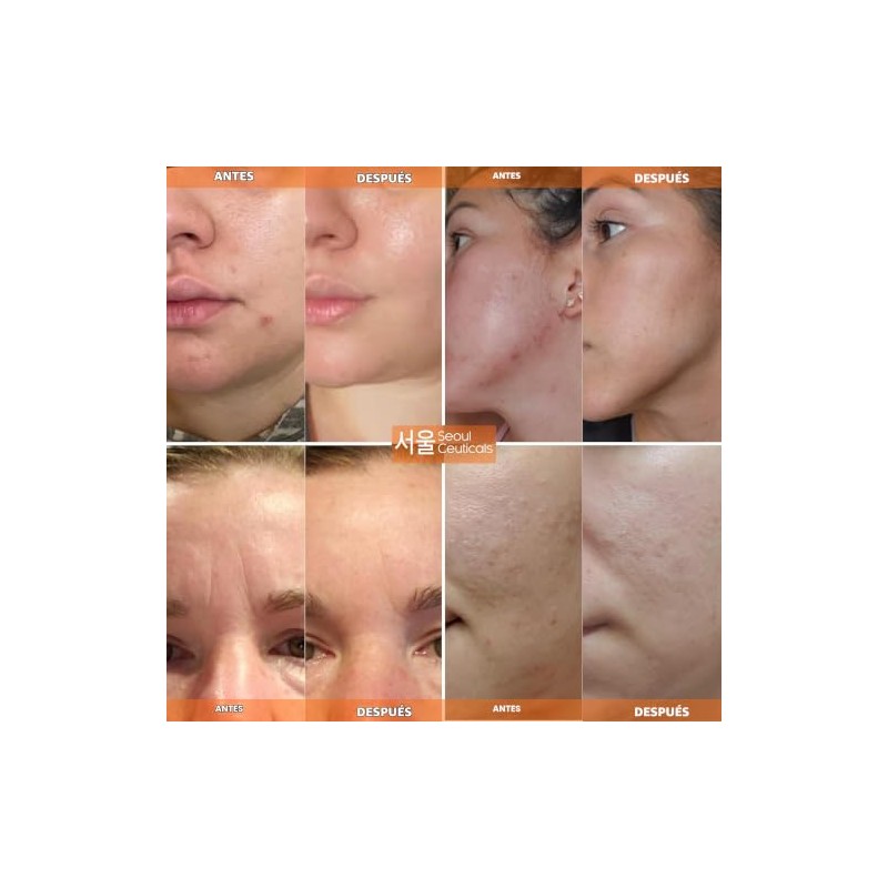 SeoulCeuticals Crema Multiusos con Extracto de Caracol, Vitamina E y