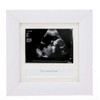 Photo Frame Ultrasound, Echography "Du wirst Oma, Opa, möchtest Du