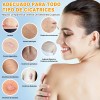Crema Cicatricial De Minimizar Y Reducir Las Cicatrices 20g
