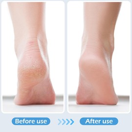 2Pcs 4 in 1 Foot Brush for Use in Shower with Pumice Stone, Rasp, Sandpaper & Foot Scrubber for Dead Skin Removal (Dark Grey,Yellow, 19.5 * 4.5 * 2cm)