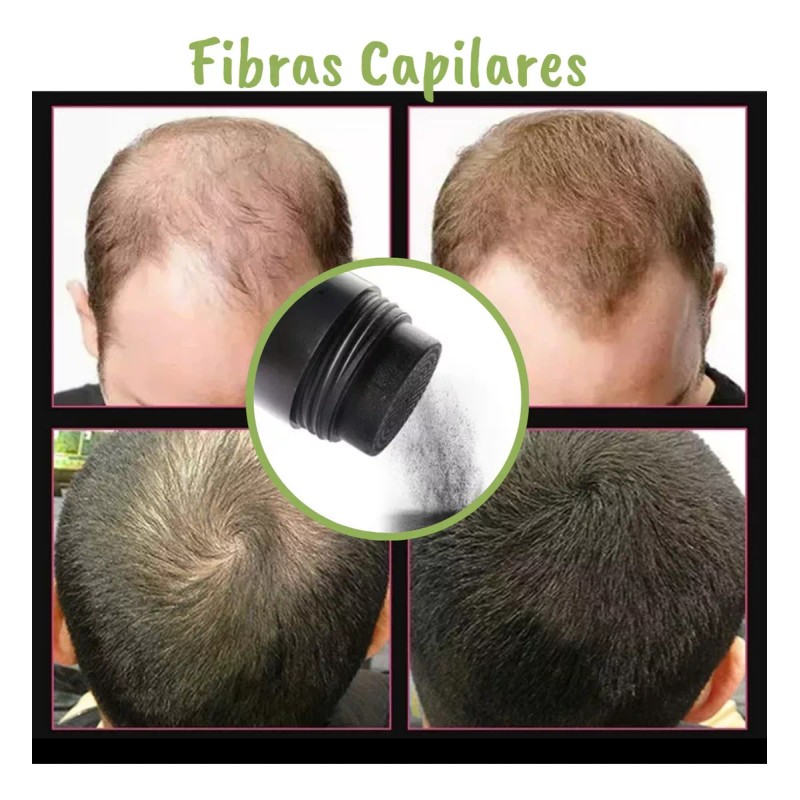 Veraly Microfibras Naturales Sustituto Cabello Disimular Calvicie