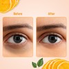 Swiss Beauty Hydra Anti Wrinkle Eye Serum Patch| Treats Dark
