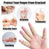 Bxian 30PCS Beige Breathable Elastic Finger Compression Sleeve Protector Thumb