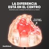 Myo Inositol Chiro 180 Gomitas Azúcar Health Hack