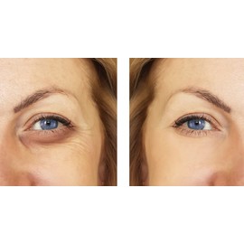 BESHA INC Verisol Collagen Bioactive Peptides (Natural Collagen Powder) Made in Germany - 2 Month Supply