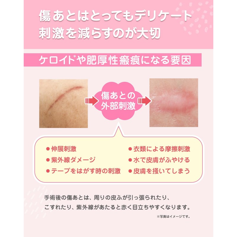 Scar Care Tape, Breathable Keloid Tape, For Wound Care, Post