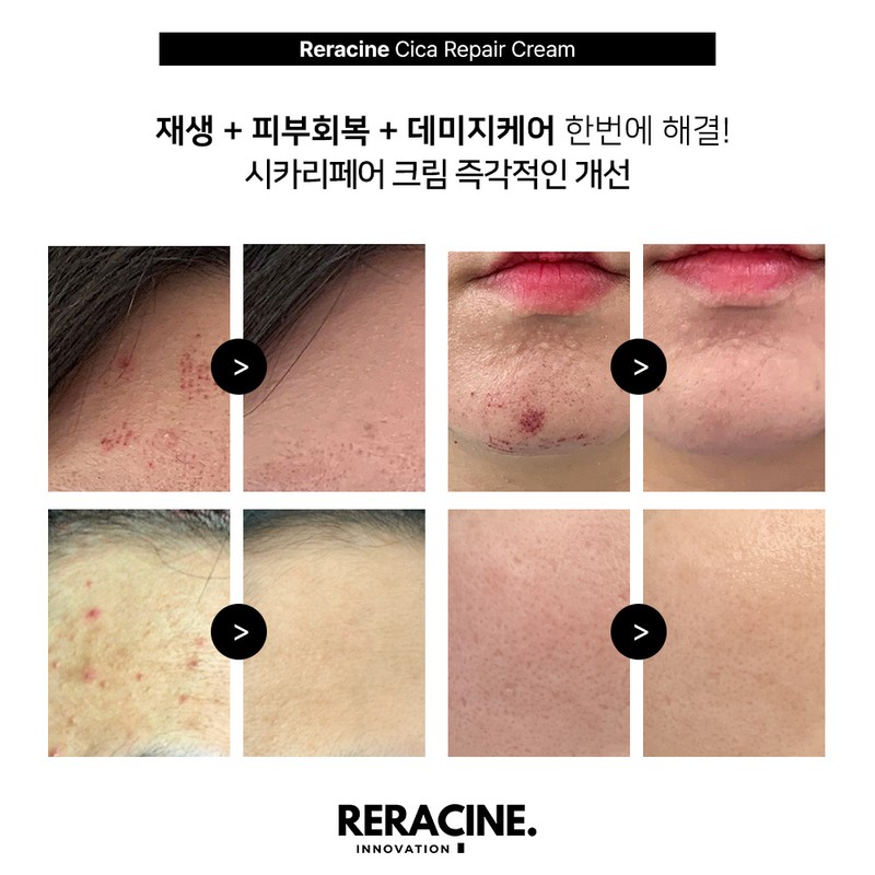 Lyricin Lilacin Cicari Repair Cream Soothing + Barrier 80g Lilacin