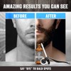 Kit de crescimento de barba para homens, kit de cultivo