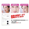 Nose Mask Pit, Size R, 14 Pieces
