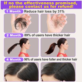 Rosemary Oil for Hair Growth,Diluted Rosemary Oil w/Scalp Massager,Hair Growth Oil Serum w/Castor Oil Biotin Argan Oil for Dry Damaged Ingrown Hair Loss Treatments Christmas Gifts Sets for Women Men