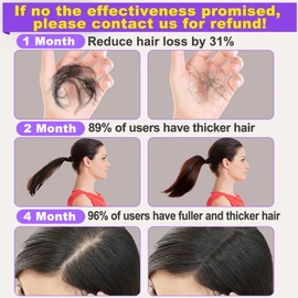 Rosemary Oil for Hair Growth,Diluted Rosemary Oil w/Scalp Massager,Hair Growth Oil Serum w/Castor Oil Biotin Argan Oil for Dry Damaged Ingrown Hair Loss Treatments Christmas Gifts Sets for Women Men