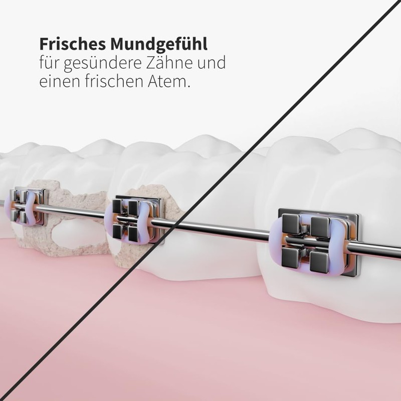 Zahnheld® Sensitive Replacement Nozzles for Aquadent Oral Irrigator