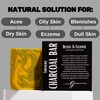 Turmeric Charcoal Bar – Natural Face & Body Soap for