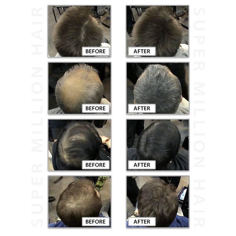 Super Million Hair - 1 x 25g Hair Building Fibres