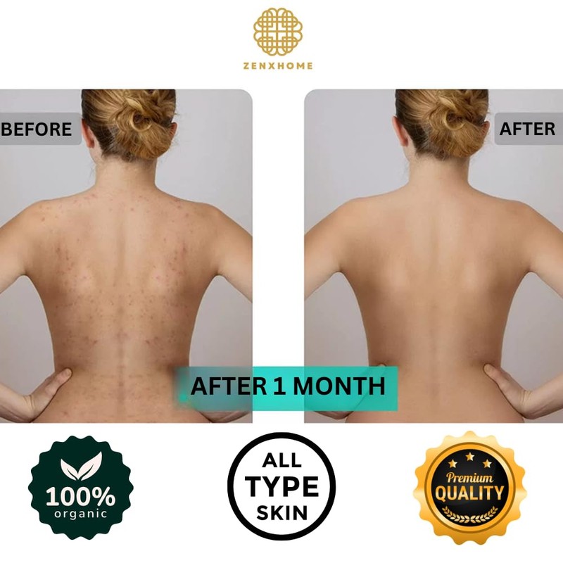 Türkische Hohe Qualität Kelebek ZenXhome Peeling handschuhe Hamam Kese Körper