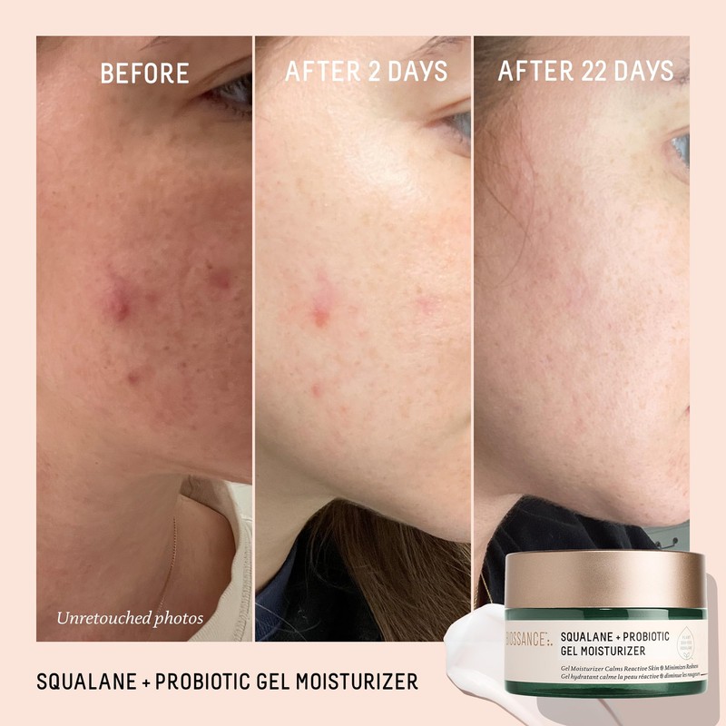 Biossance Squalane + Probiotic Balancing Face Gel Moisturizer - Advanced