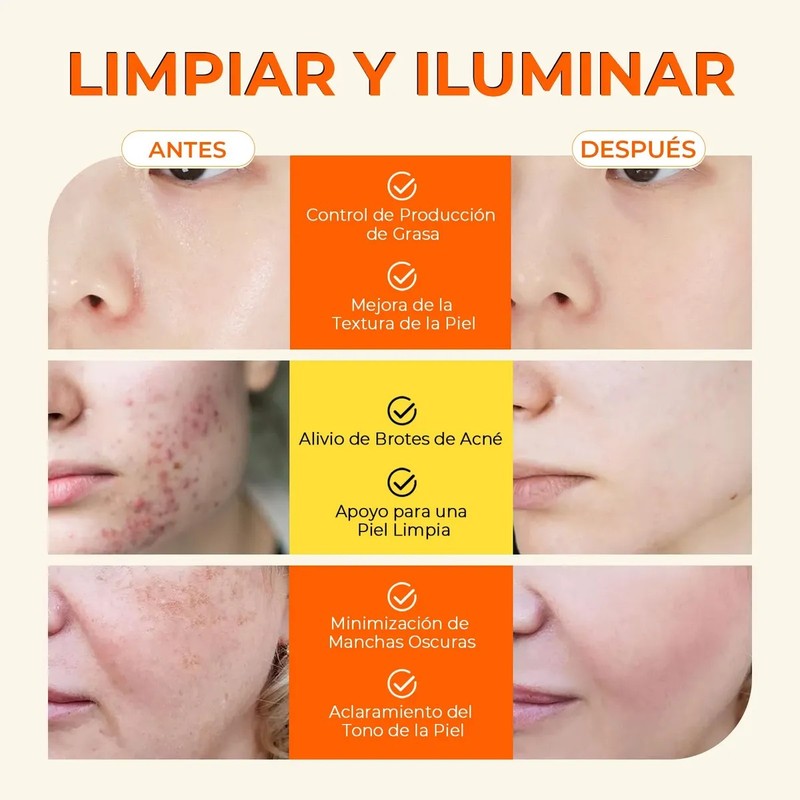 Aclarante Manchas Poros Acné Grasa Pads Cúrcuma Kójico 50pz