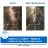 Uriage Ds Champú Caspa Moderada Con Piroctona Olamina 200 Ml