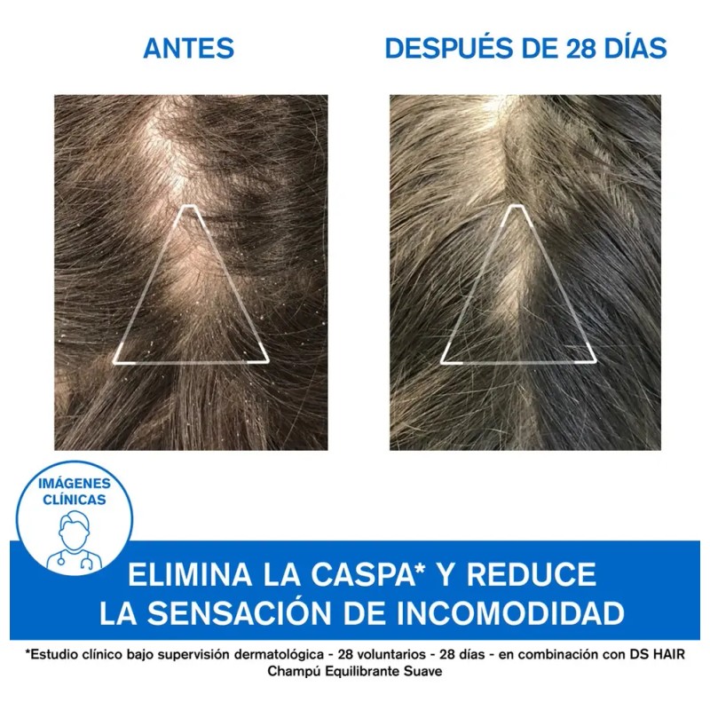 Uriage Ds Champú Caspa Moderada Con Piroctona Olamina 200 Ml