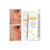 Crema Cicatricial De Minimizar Y Reducir Las Cicatrices 20g