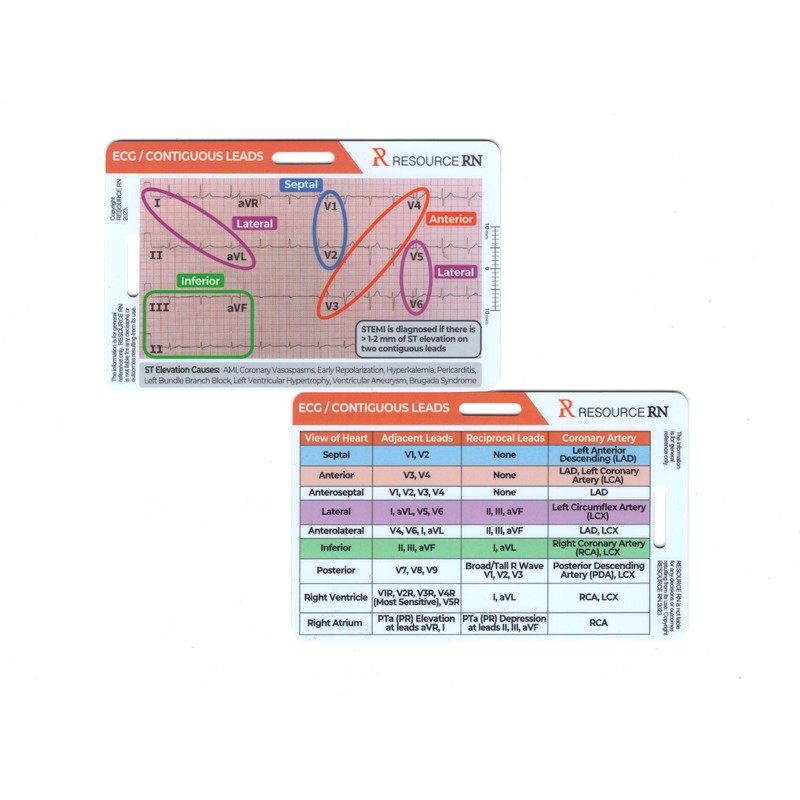 EKG STEMI Analysis Badge Card for Rapid Interpretation – Compatible