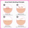 EFLY Pimple Patches for Face, Acne Patches Hydrocolloid with Tea