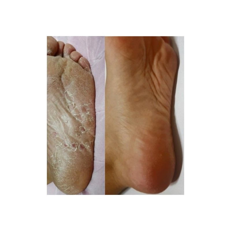 Foot Pack Master Ferrorin Rose Scent 2-Use Pack 1 Pack