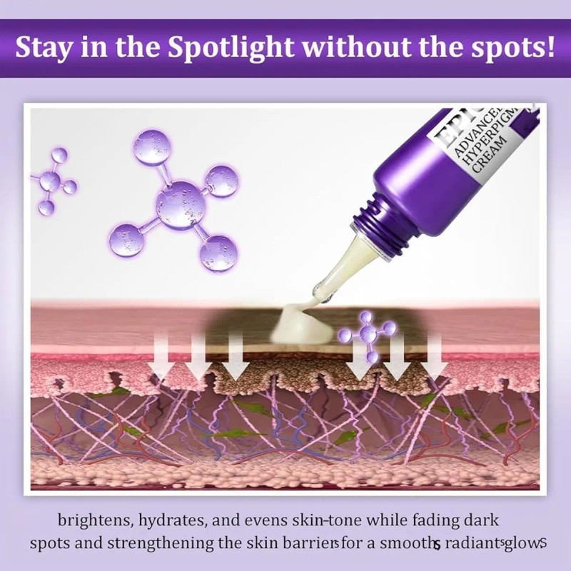 Crema Epiglow Melanex Advanced Anti-hiperpigmentación