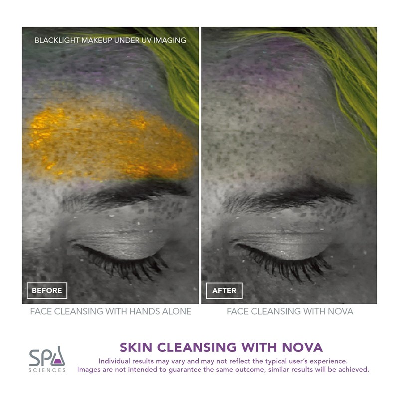 Spa Sciences - NOVA - Sonic Cleansing Brush with Bristles