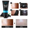 Blackhead Remover Mask, Blackhead Mask, Peel Off Black Mask, Blackhead