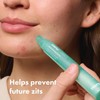 Hero Cosmetic Acne Correction Removal Gel Pen - Maximum Strength