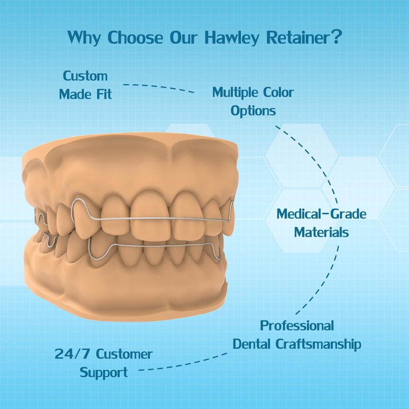 Hawley Retainers for Adults, Custom Retainers for Upper and Lower