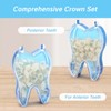 YAFIYGI 100 PCS Temporary Crowns for Teeth Dental Crown Kit
