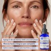 Skin Perfection Matrixyl 3000, Palmitoyl Oligopeptide and Tetrapeptide 7, Reduces